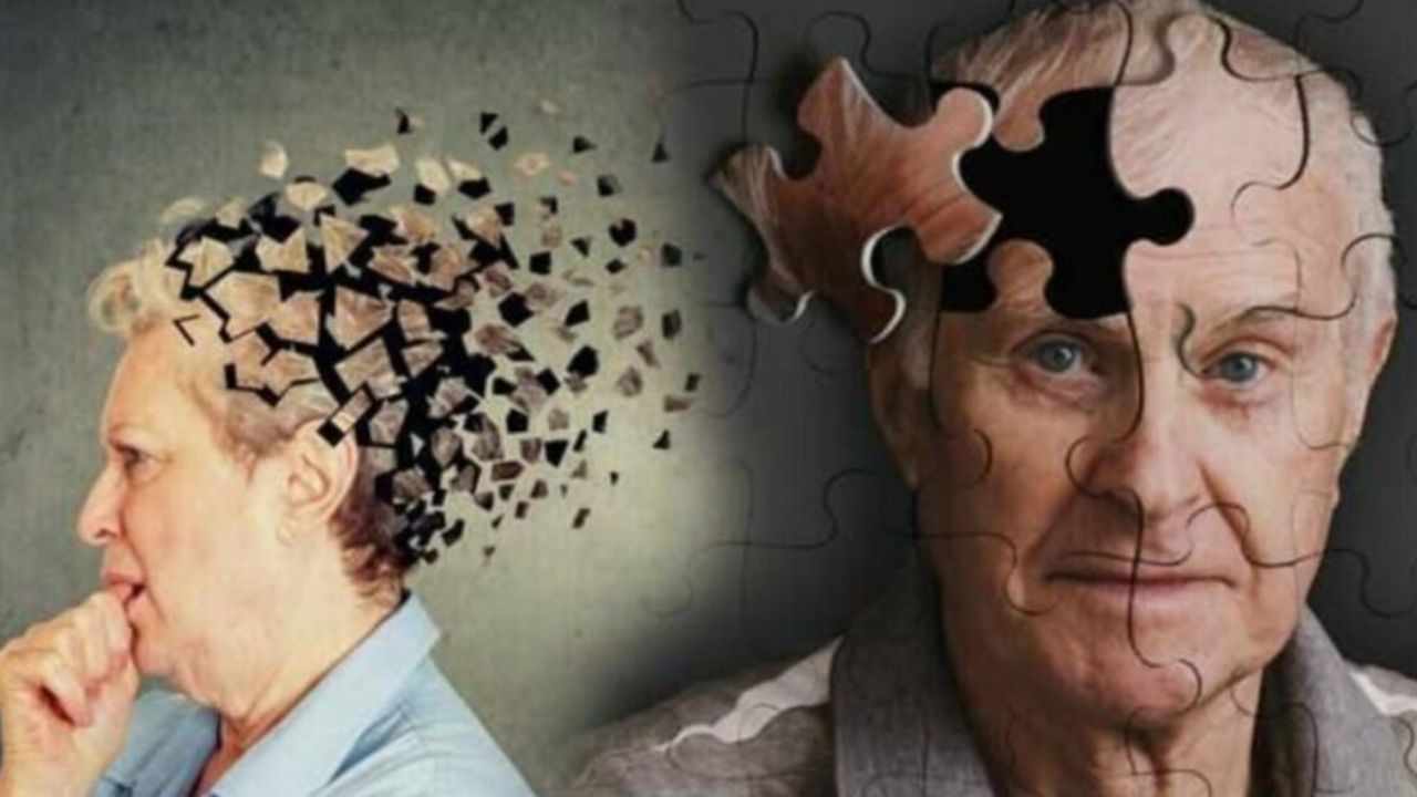 Rapor kanıtladı! Alzheimer hastalığı insandan insana bulaşabilir mi?